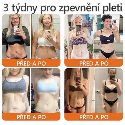 🎁 Doporučení dermatologa 🐝 ✨Sinvie® Krém na obnovu pleti s včelím jedem 🔥 Český vývoj, výroba a dodávka v České republice🎁