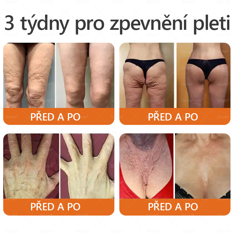 🎁 Doporučení dermatologa 🐝 ✨Sinvie® Krém na obnovu pleti s včelím jedem 🔥 Český vývoj, výroba a dodávka v České republice🎁