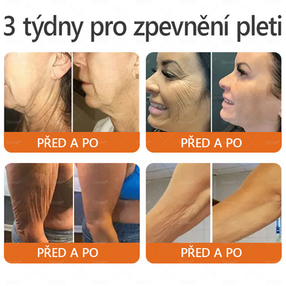 🎁 Doporučení dermatologa 🐝 ✨Sinvie® Krém na obnovu pleti s včelím jedem 🔥 Český vývoj, výroba a dodávka v České republice🎁