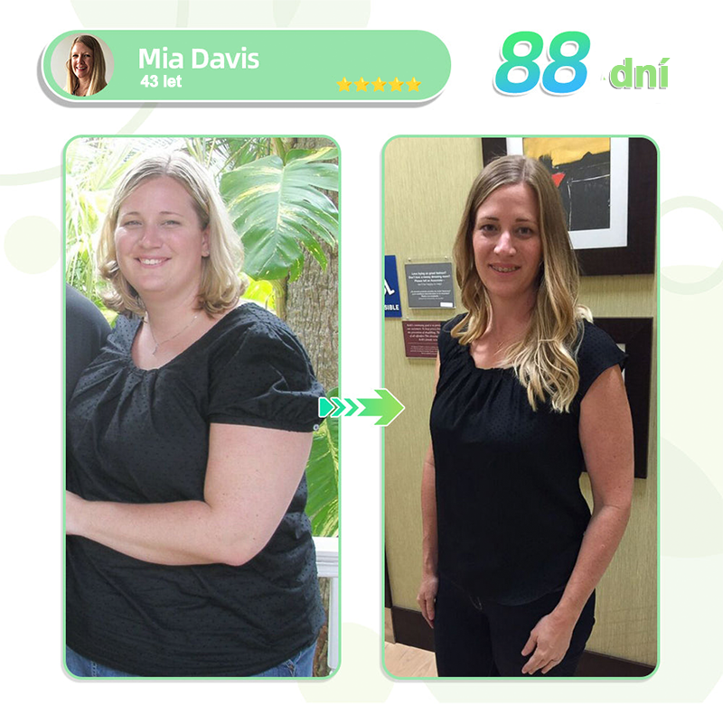 🎁 [Výsledky již po 7 dnech] 🌲Voilaist® nano náplast s mikrojehlami SMGT-GLP-1 (Bez bolesti, dlouhodobý účinek, pomáhá při cukrovce, obezitě a kardiovaskulárních onemocněních)🎁