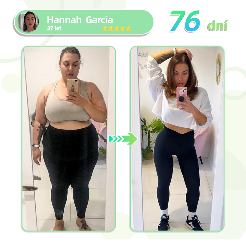 🎁 [Výsledky již po 7 dnech] 🌲Voilaist® nano náplast s mikrojehlami SMGT-GLP-1 (Bez bolesti, dlouhodobý účinek, pomáhá při cukrovce, obezitě a kardiovaskulárních onemocněních)🎁