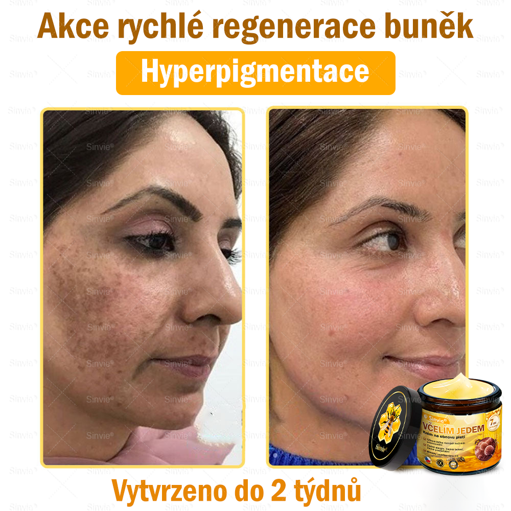 🎁 Doporučení dermatologa 🐝 ✨Sinvie® Krém na obnovu pleti s včelím jedem 🔥 Český vývoj, výroba a dodávka v České republice🎁